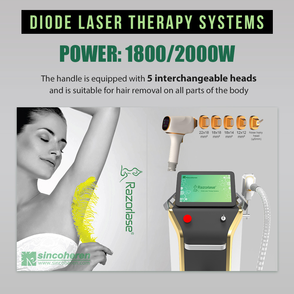 Razorlase SDL-M marketing graphic from the company's own site